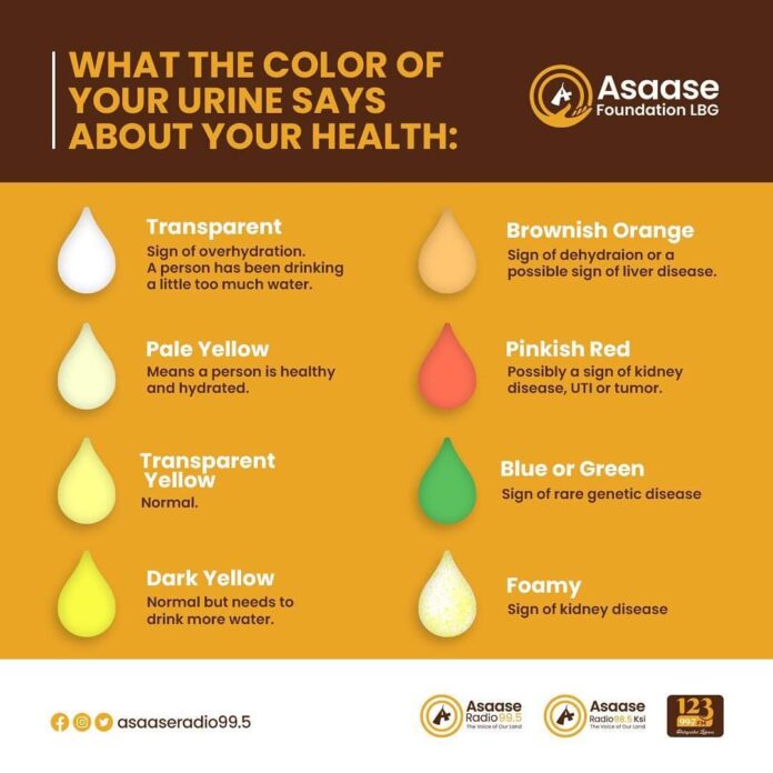WHAT THE COLOR OF YOUR URINE SAYS ABOUT YOUR HEALTH