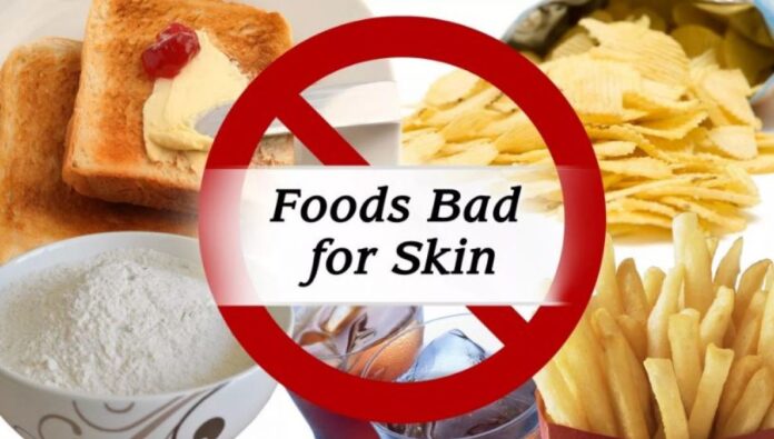 5 worst foods for your skin (and what to eat instead) 5 worst foods for your skin (and what to eat instead)